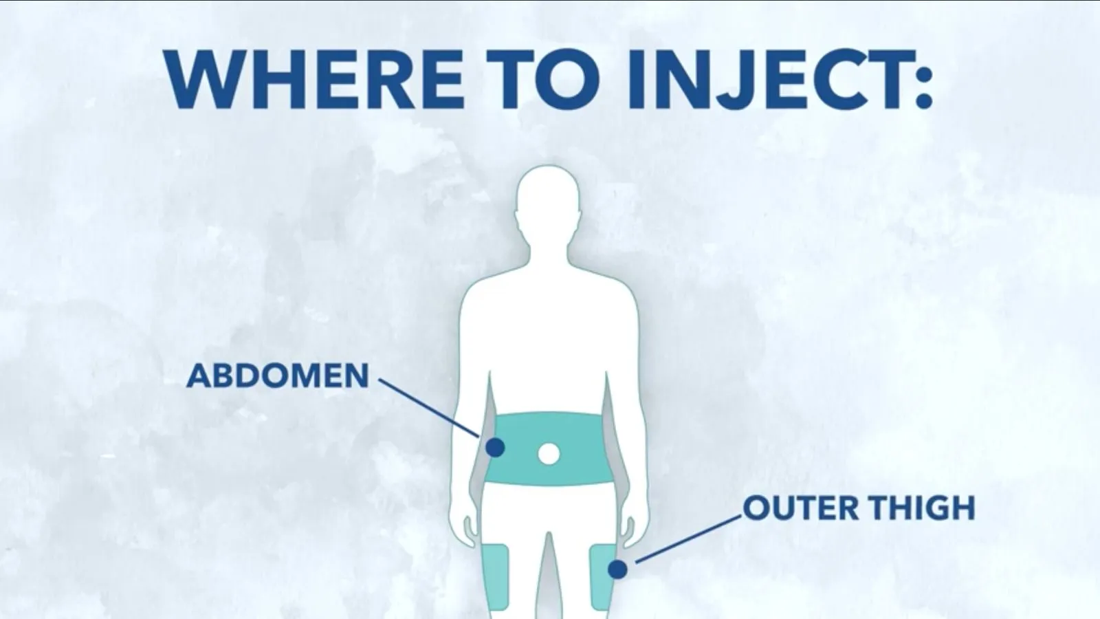 Where to injection semaglutide, places to inject