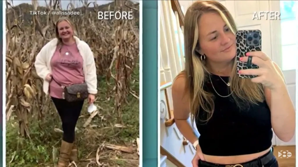 Before and after